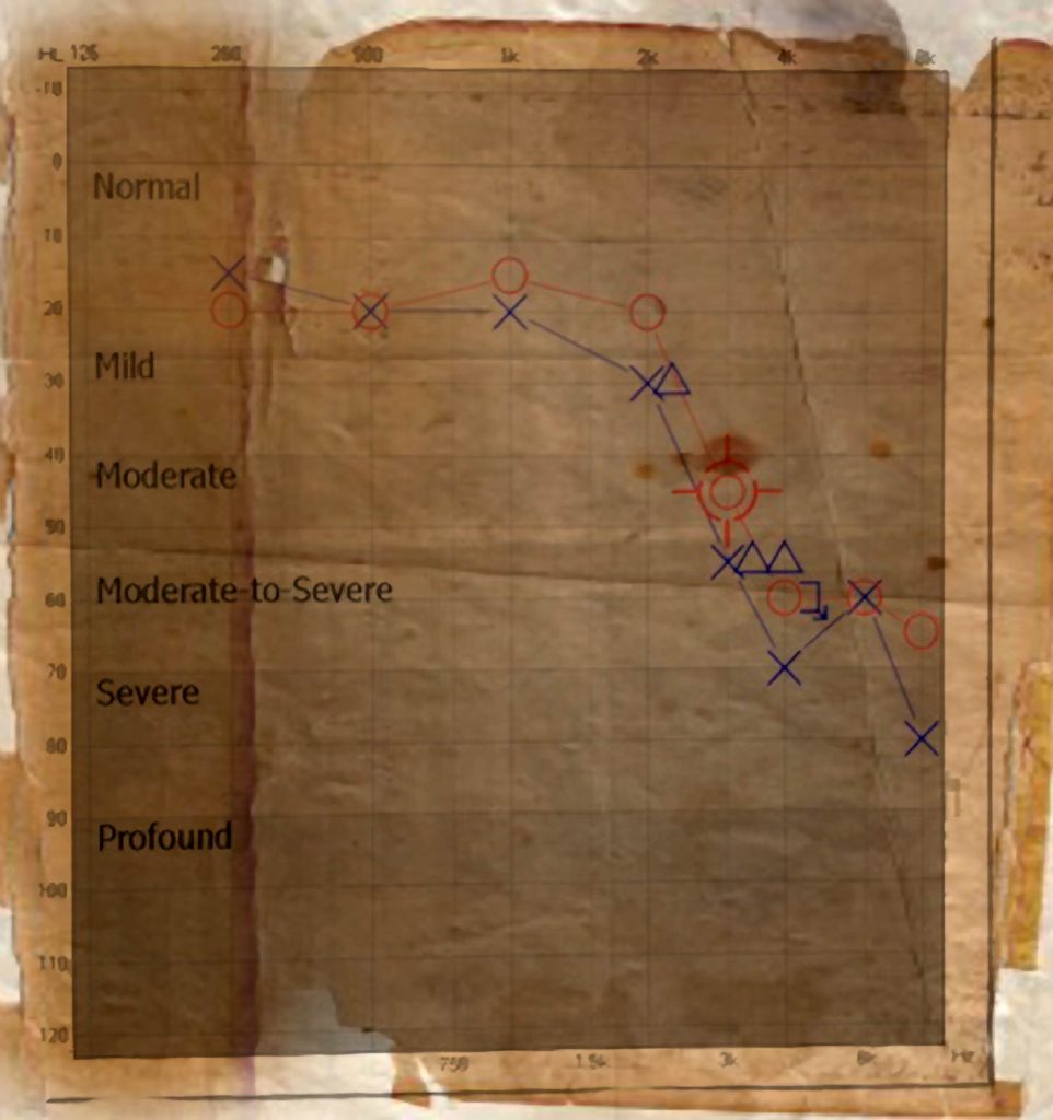 hearing-chart